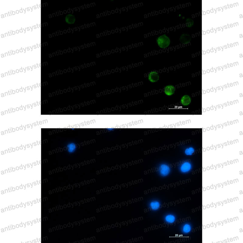 Anti-ME2 Antibody (R1S32)