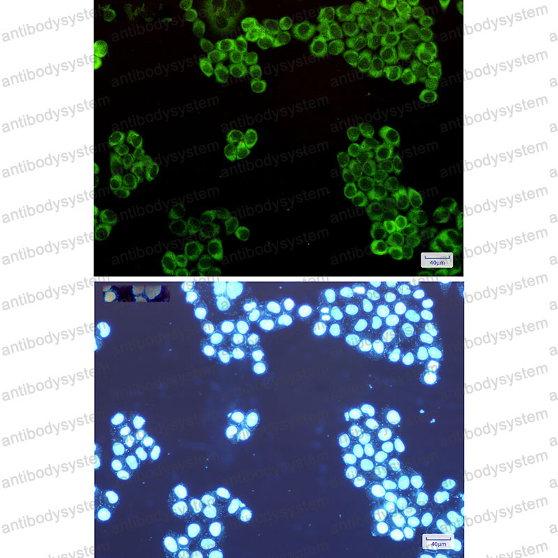 Anti-WARS1 Antibody (R1S35)