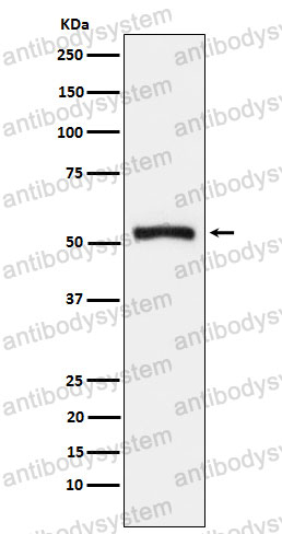Anti-WARS1 Antibody (R1S34)