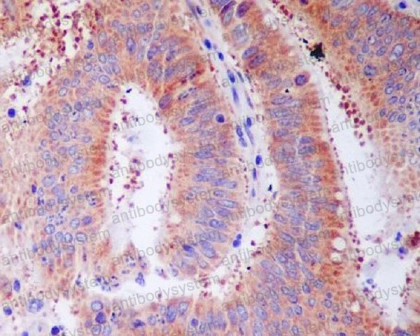 Anti-RPS3 Antibody (R1C33)