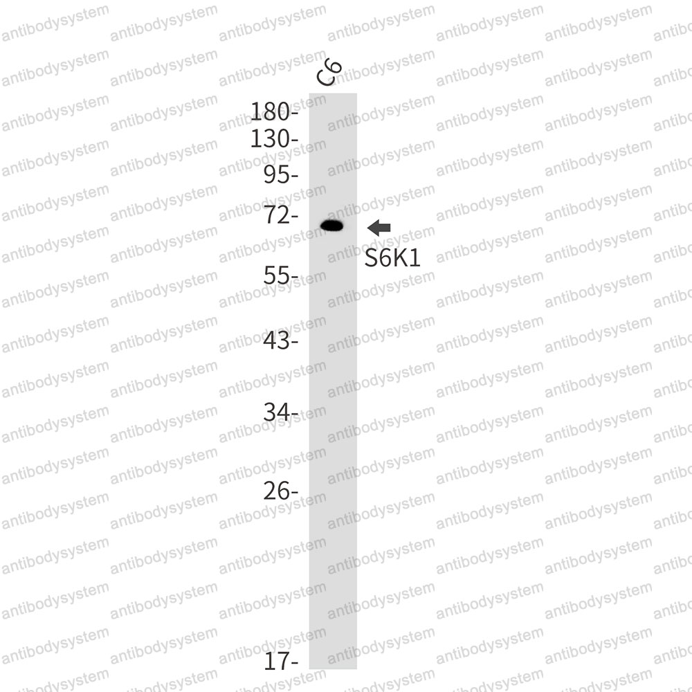 Anti-S6K1/RPS6KB1 Antibody (R1S37)