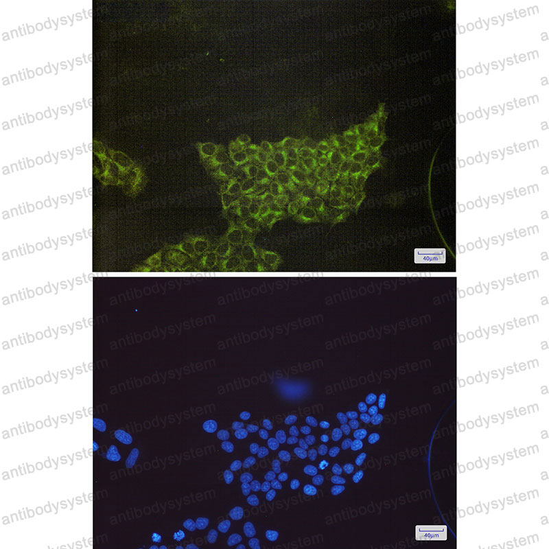 Anti-S6K1/RPS6KB1 Antibody (R1S36)