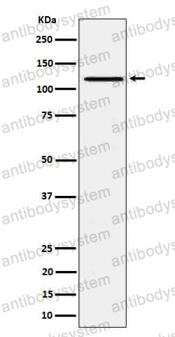 Anti-Phospho-JAK1 (Y1034 + Y1035) Antibody (R1S39)