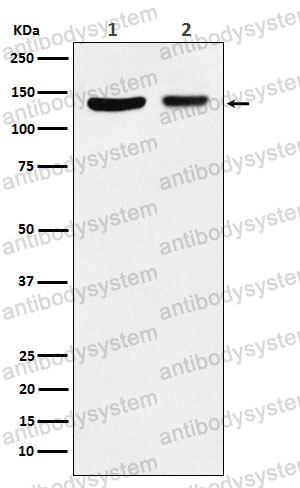 Anti-JAK1 Antibody (R1S38)
