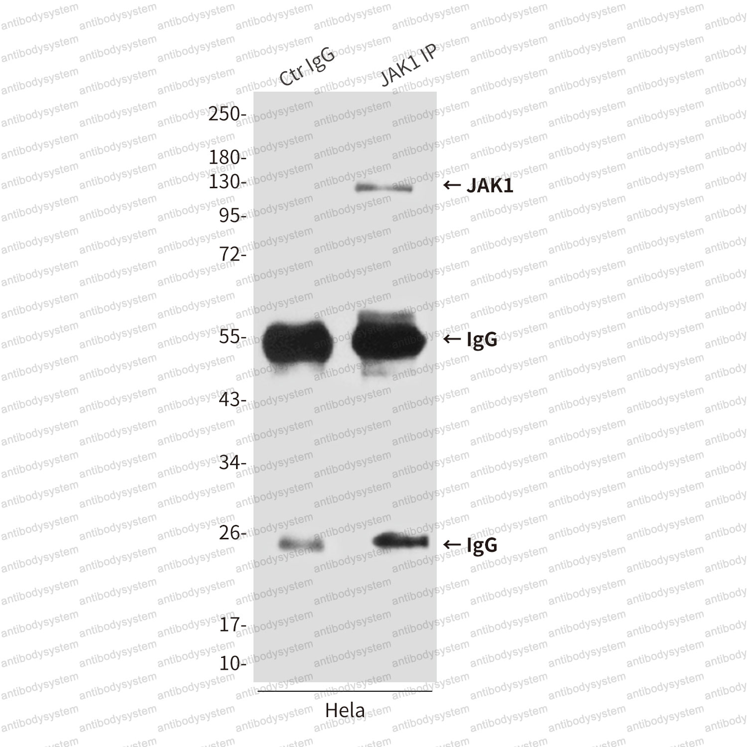 Immunoprecipitation for Anti-JAK1 Antibody (R3G36) ?>