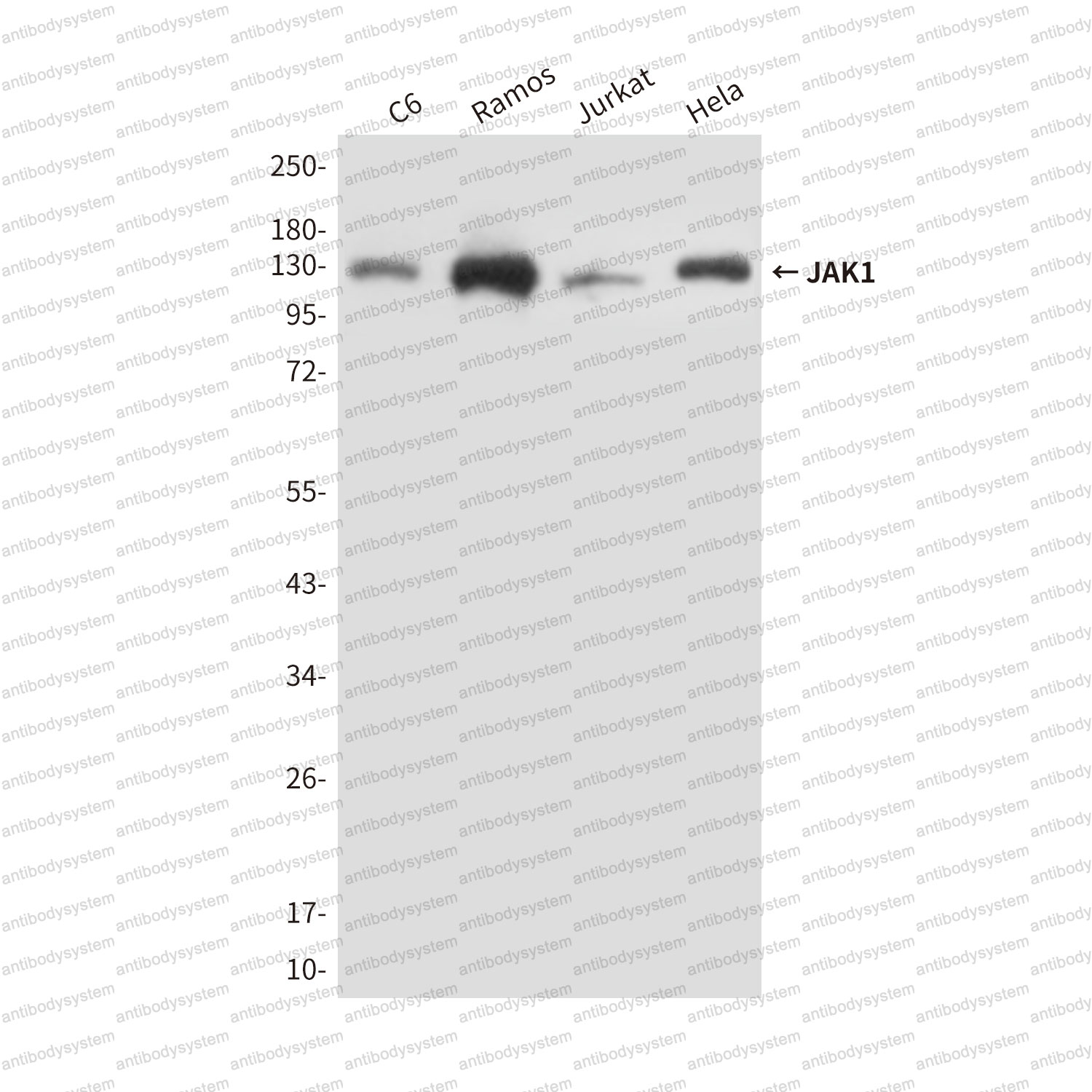 Western blot for Anti-JAK1 Antibody (R3G36) ?>