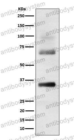 Anti-LORICRIN Antibody (R1S40)