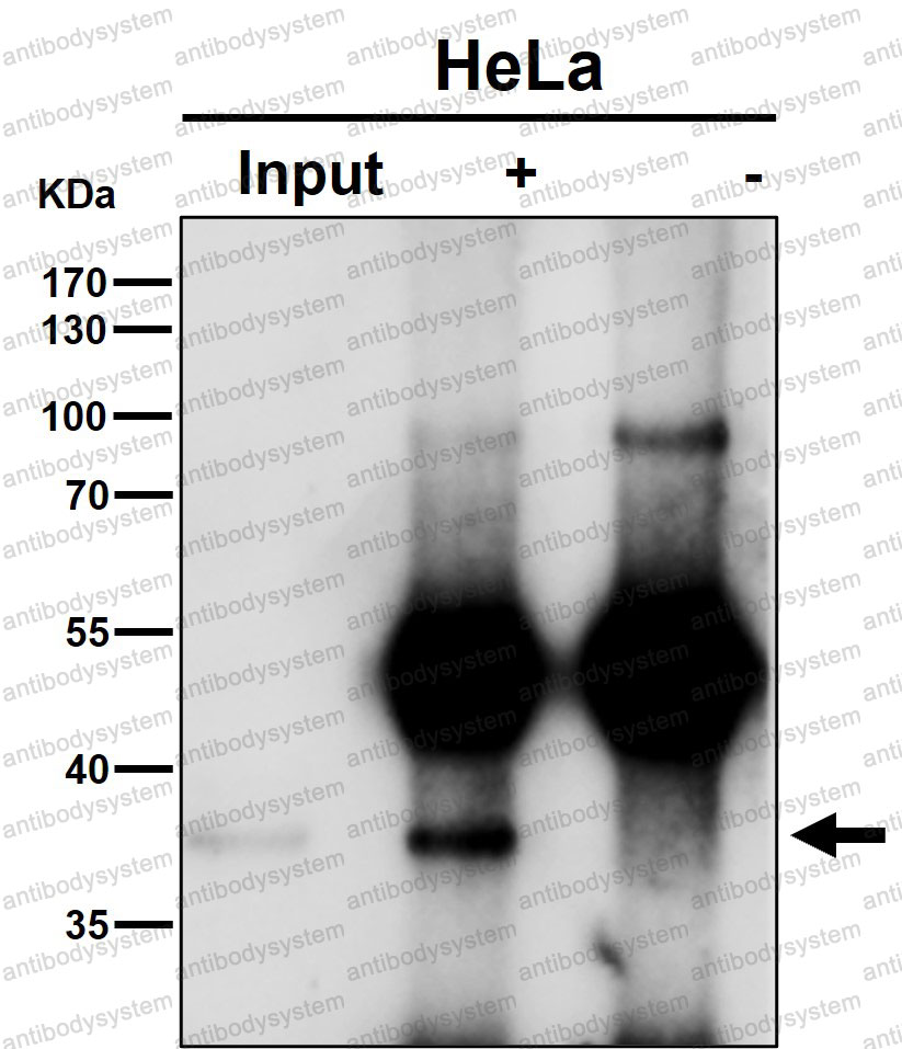 Anti-NFYA Antibody (R1S41)