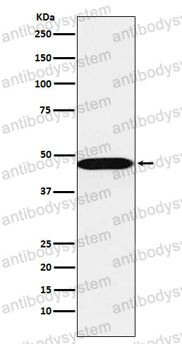 Anti-AHCY Antibody (R1S43)