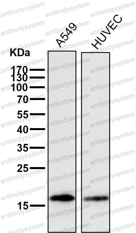 Anti-CFL1 Antibody (R1B55)