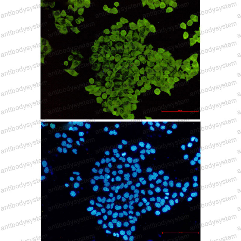 Anti-CFL1 Antibody (R1S44)