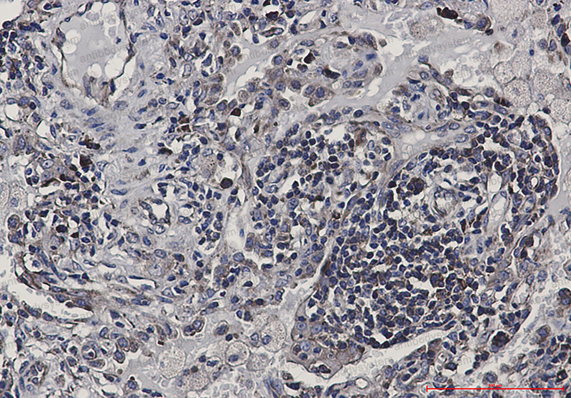 Anti-EIF4B Antibody (R1S46)