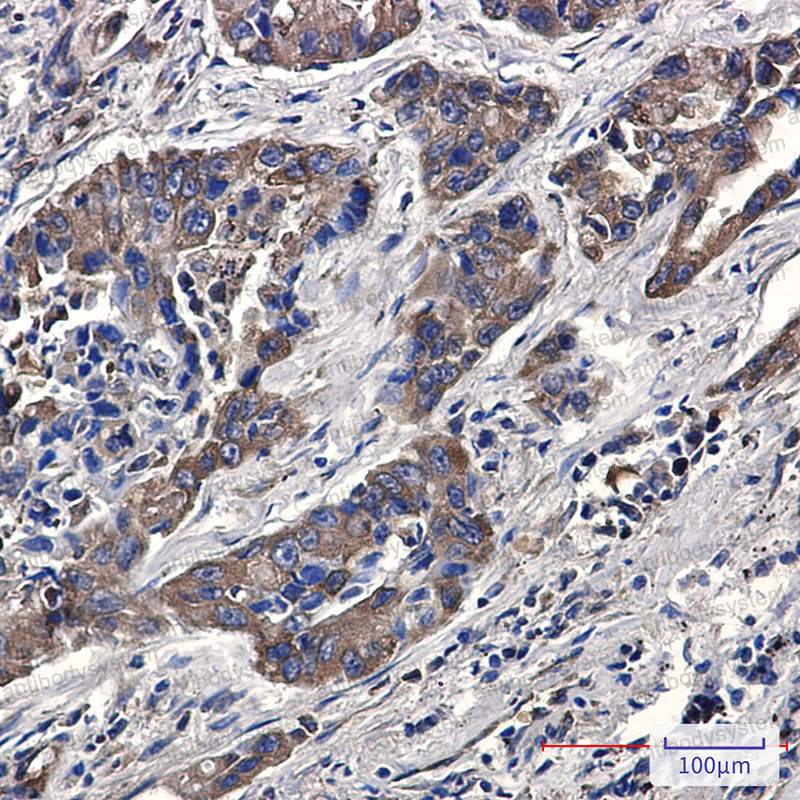 Anti-Phospho-EIF4B/eIF4B (Ser406) Antibody (R1S45)