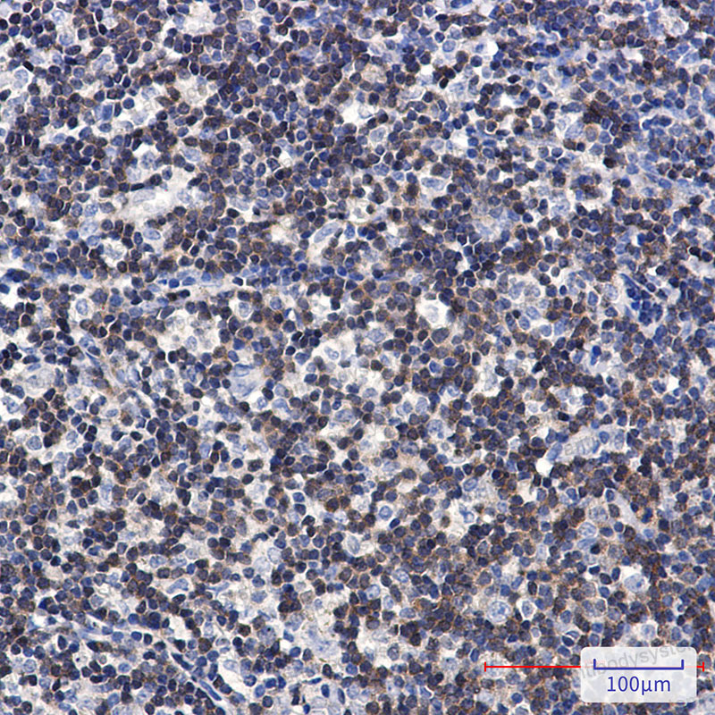Anti-DGKA Antibody (R1S47)