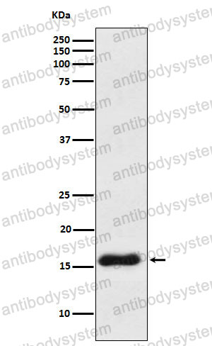 Anti-VAMP1 Antibody (R1S49)