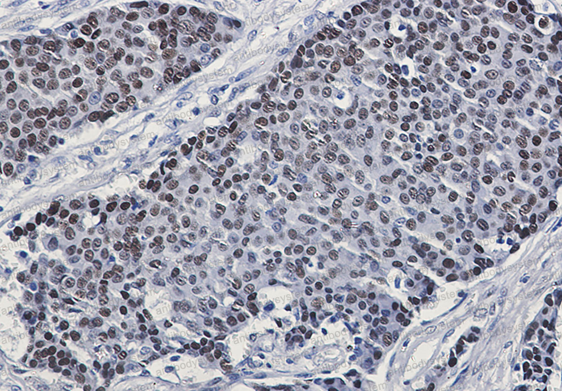 Anti-Phospho-GATA3 (Ser308) Antibody (R1S50)