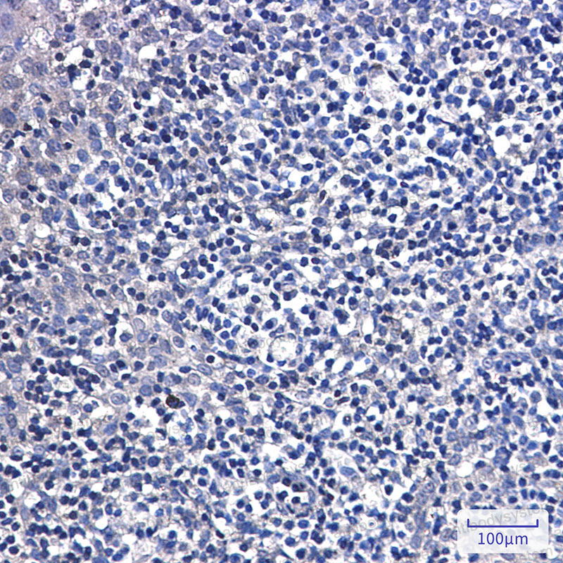 Anti-DTYMK Antibody (R1S52)
