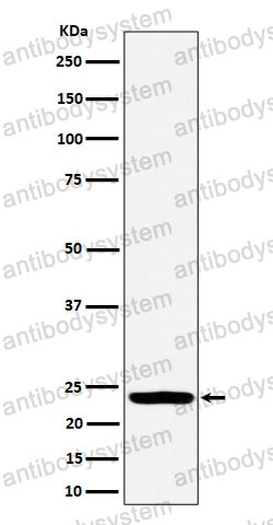 Anti-DTYMK Antibody (R1S51)