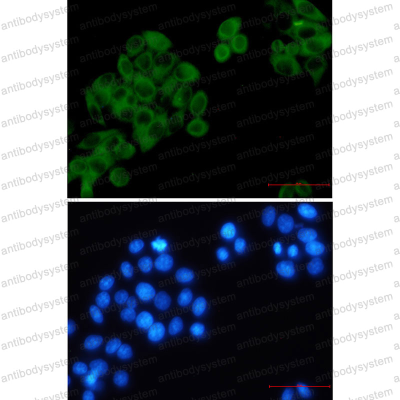 Anti-RRM1 Antibody (R1S53)