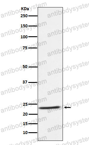 Anti-IL32 Antibody (R1S55)
