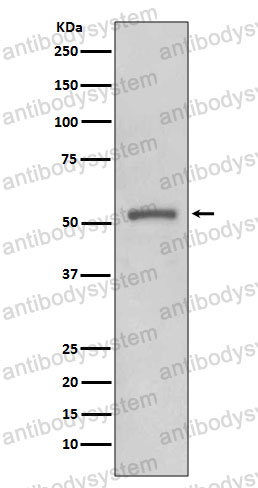 Anti-MMP11 Antibody (R1S56)