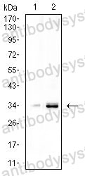 Western blot for Anti-CCND1 Antibody (R3G56) ?>