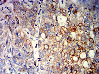 Immunohistochemical for Anti-CCND1 Antibody (R3G55) ?>