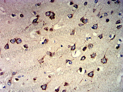 Immunohistochemical for Anti-CCND1 Antibody (R3G55) ?>