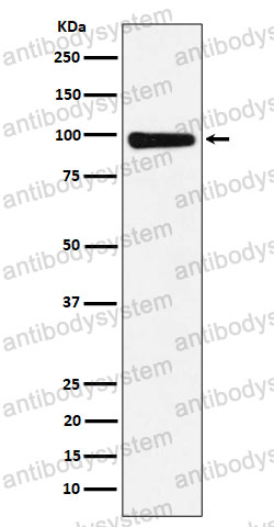 Anti-CHM Antibody (R1S57)