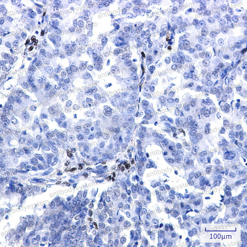 Anti-NR2F2 Antibody (R1S58)