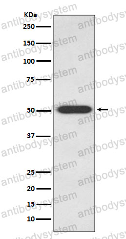 Anti-EDNRB/ETRB Antibody (R1S59)