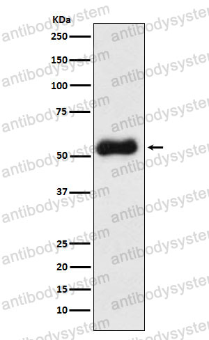 Anti-TBXAS1 Antibody (R1S60)