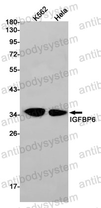 Anti-IGFBP6 Antibody (R1S61)