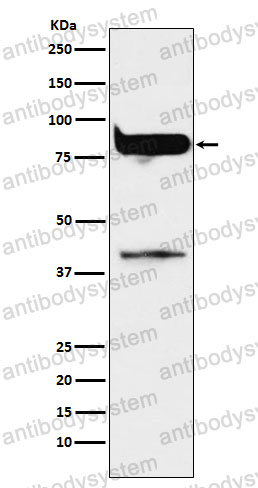 Anti-PRKCH Antibody (R1S62)