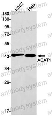 Anti-ACAT1 Antibody (R1S65)