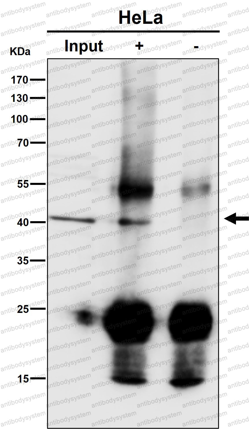 Anti-ACAT1 Antibody (R1S64)
