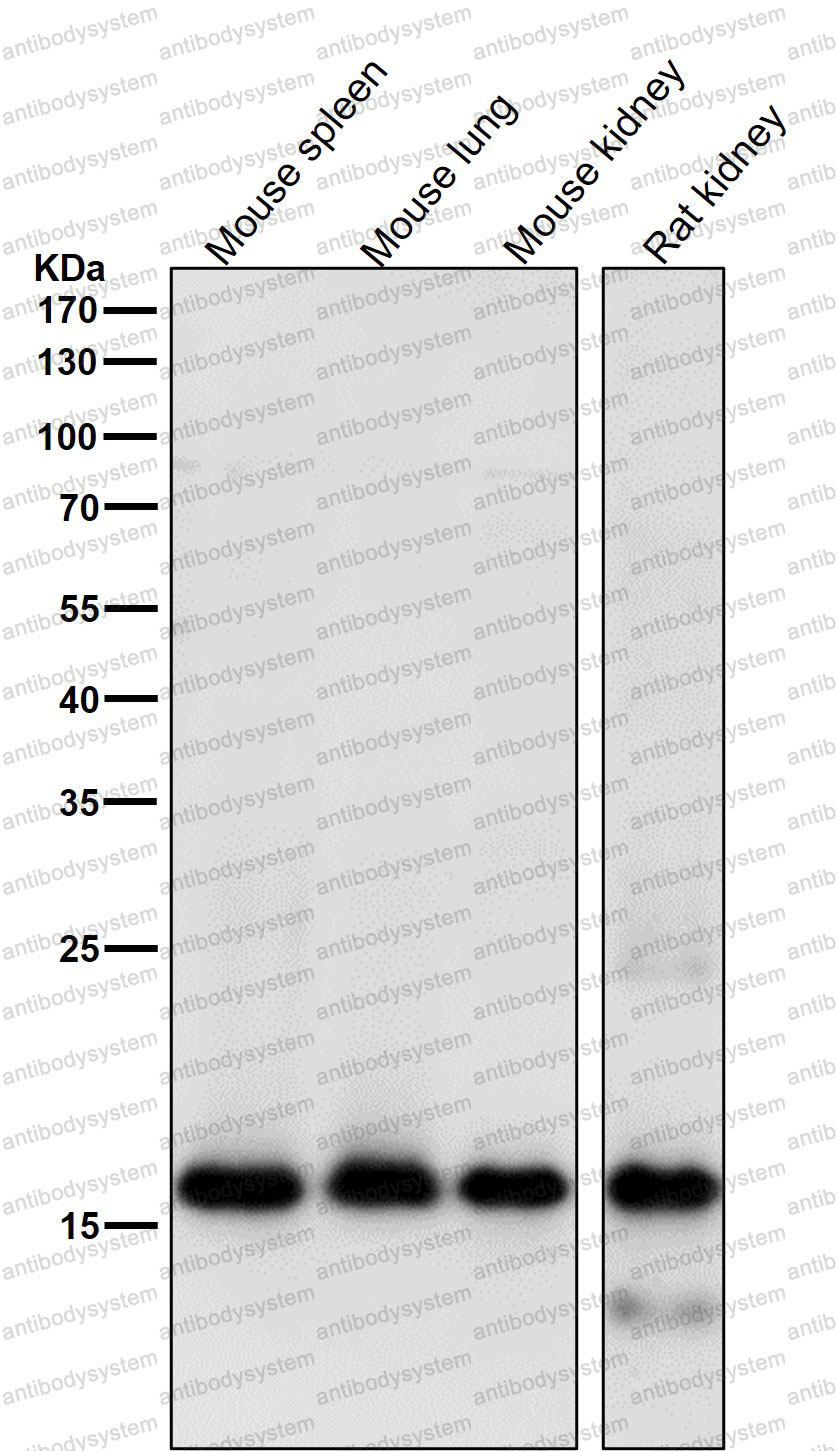 Anti-MYL9 Antibody (R1S66)