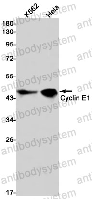 Anti-CCNE1 Antibody (R1S67)
