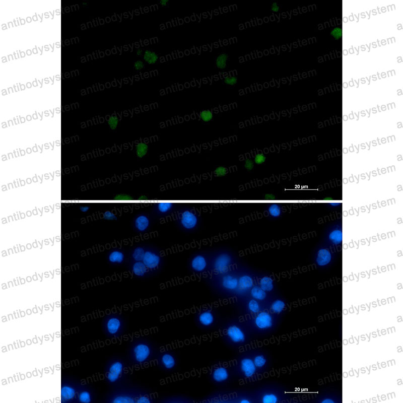 Anti-POLR2A Antibody (R1S68)