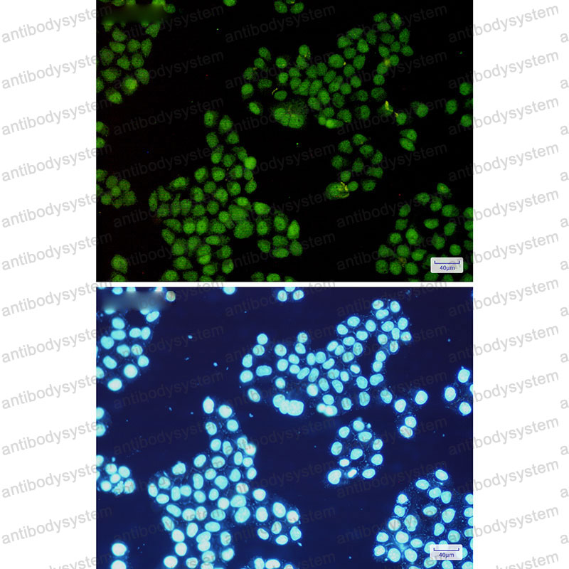 Anti-CDK2 Antibody (R1S72)