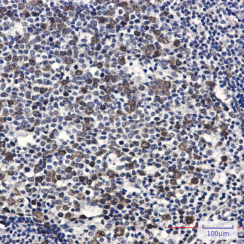 Anti-Phospho-CDK2 (Thr14) Antibody (R1S71)