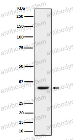 Anti-Phospho-CDK2 (T160) + CDK1 (T161) Antibody (R1S69)