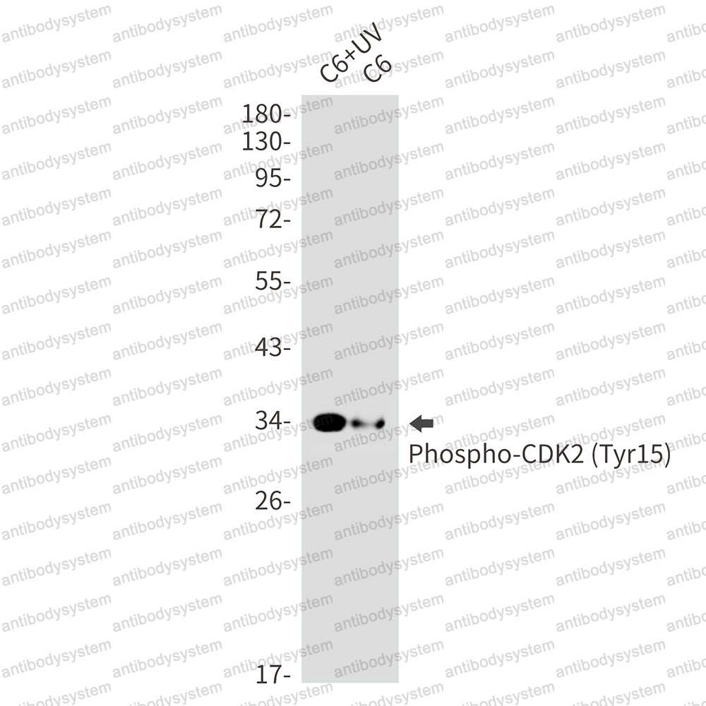 Anti-Phospho-CDK2 (Tyr15) Antibody (R1S70)