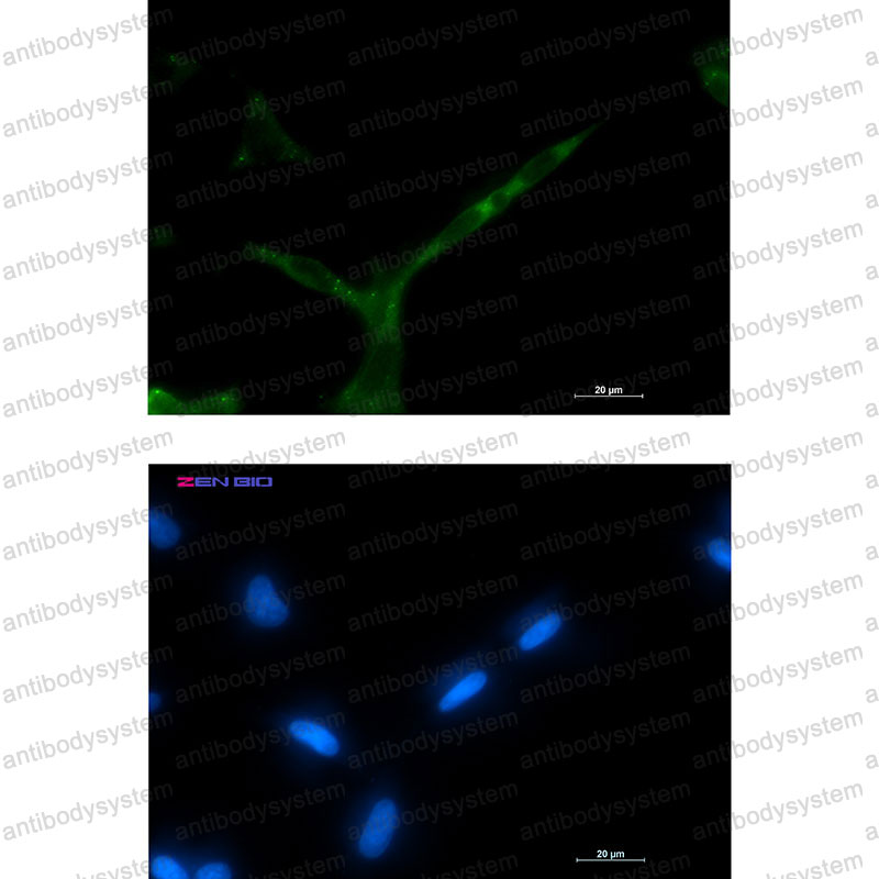 Anti-APC Antibody (R1S73)
