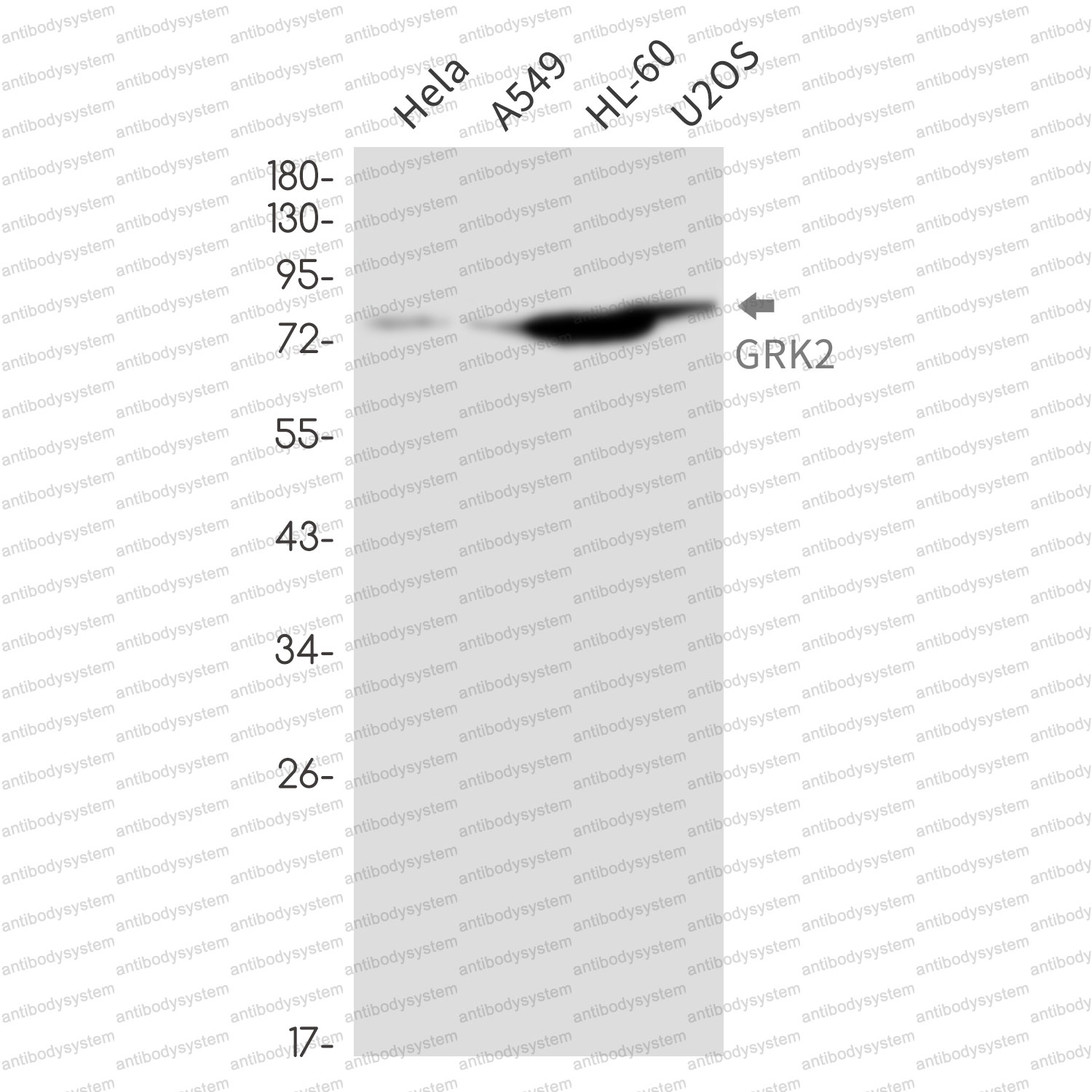 Anti-GRK2 Antibody (R1S74)