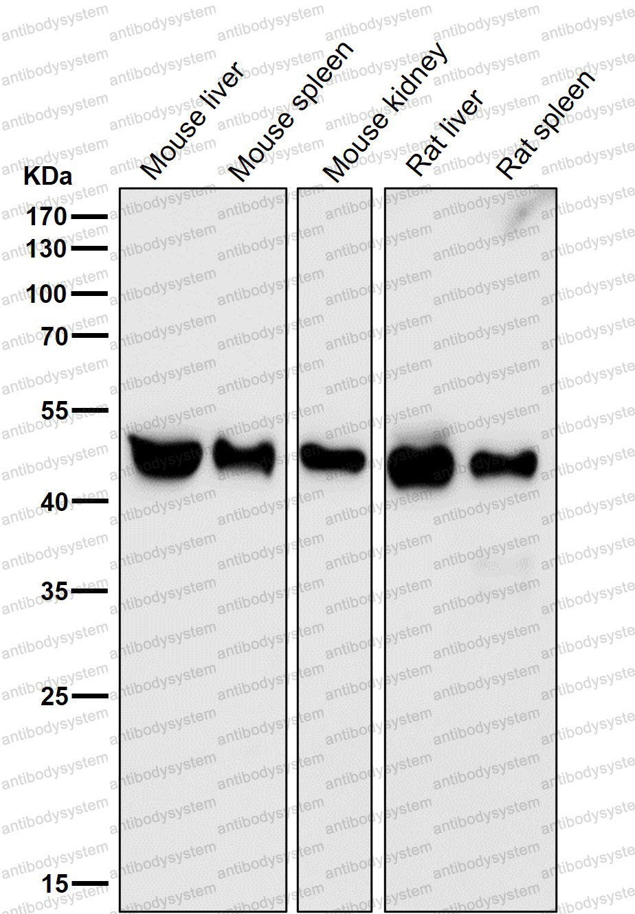 Anti-TACR1 Antibody (R1S75)