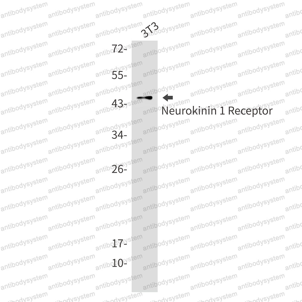 Anti-TACR1 Antibody (R1S76)