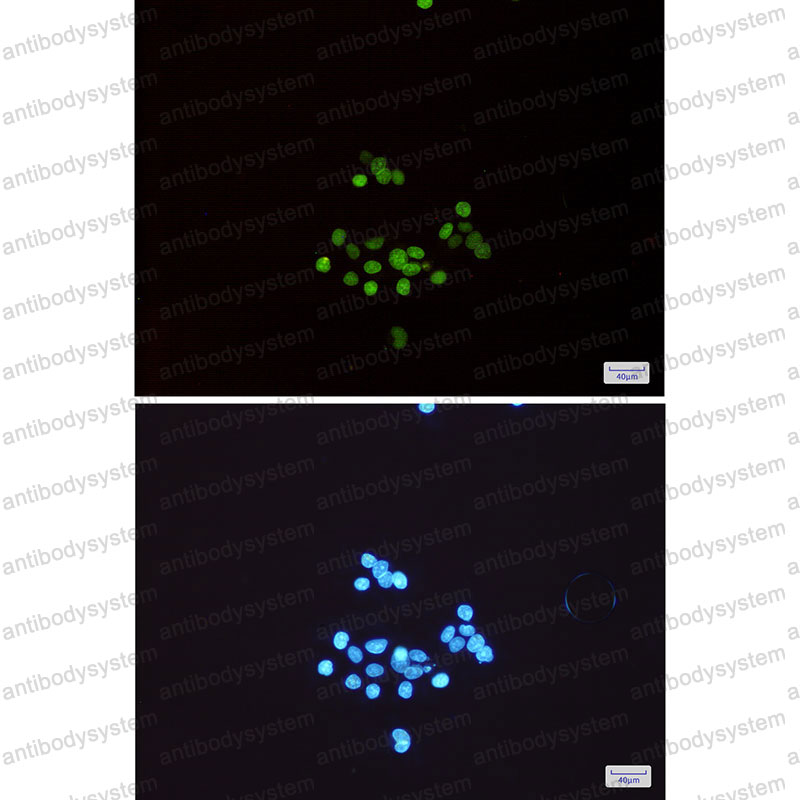 Anti-MCM3 Antibody (R1S79)