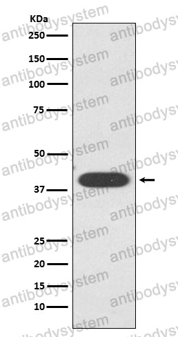 Anti-ZA2G/AZGP1 Antibody (R1S80)