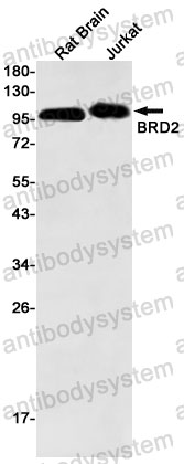 Anti-BRD2 Antibody (R1S81)